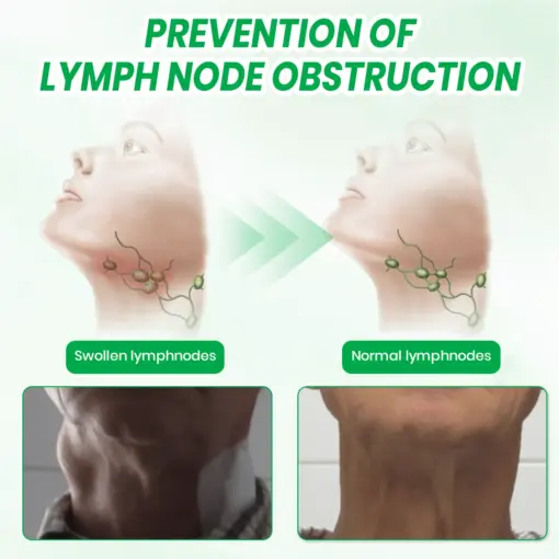 KUBOZN® Lymphatic Detox Herbal Cream