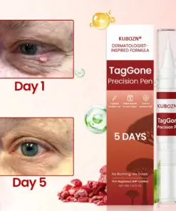 KUBOZN® TagGone Precision Pen