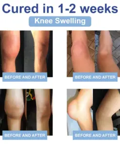 KUBOZN® Advanced Magnesium Pain Relief Cream