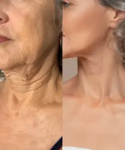 KUBOZN® Exosome Cellular Age-Reverse & Firming Capsules