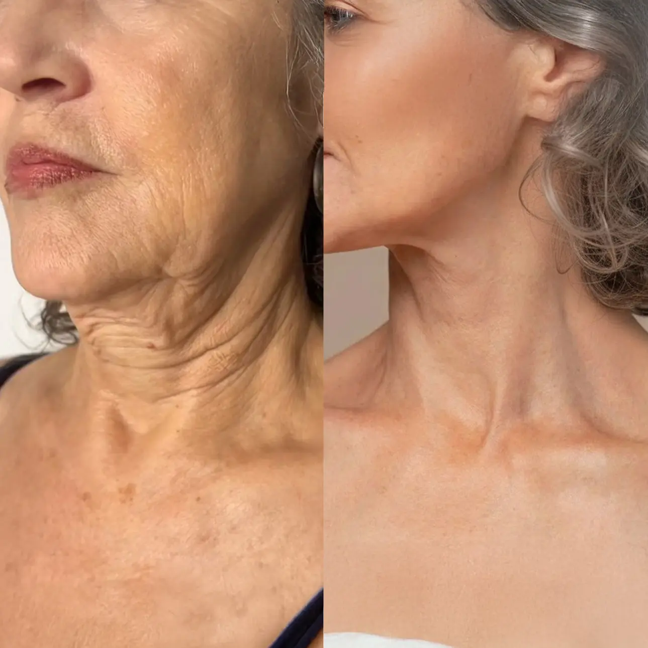 KUBOZN® Exosome Cellular Age-Reverse & Firming Capsules