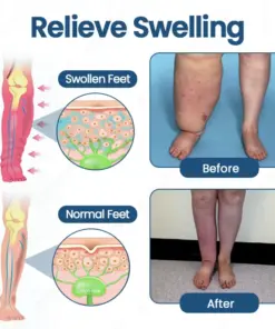 KUBOZN® Roll-On Cream for Lymphatic Drainage & Swelling Relief