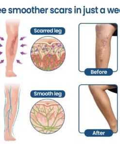 KUBOZN® Triple-Roller Microcurrent ScarRepair Gel