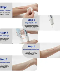 KUBOZN® Triple-Roller Microcurrent ScarRepair Gel