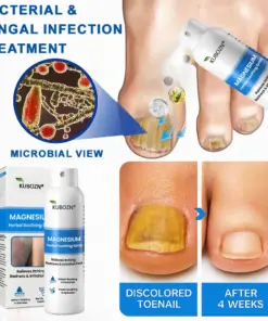 KUBOZN® Magnesium Herbal Psoriasis Spray