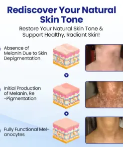 KUBOZN® Vitiligo Repigmentation Spray