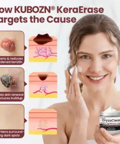 KUBOZN®KeraErase Dual-Action Renewal Cream