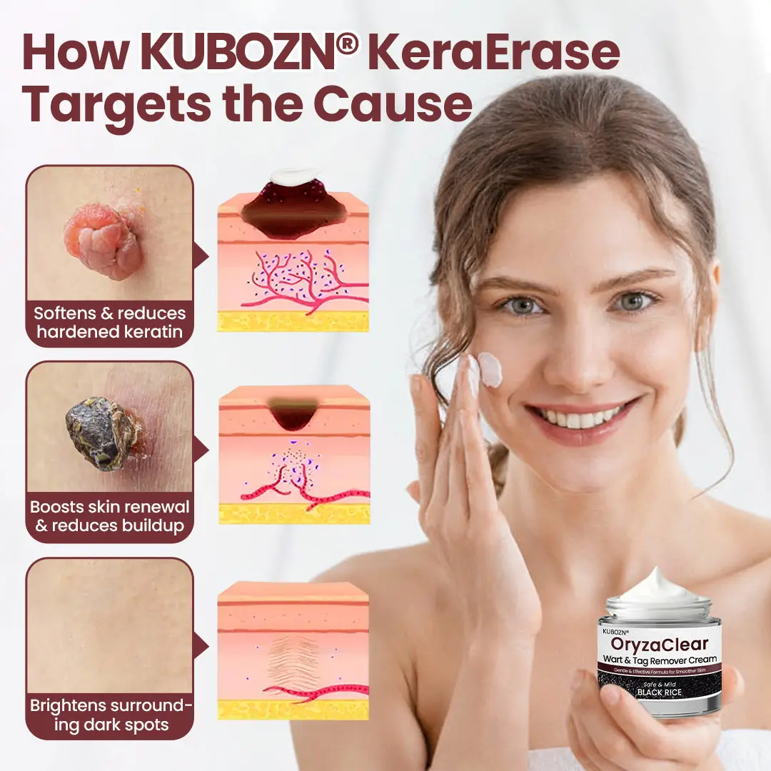 KUBOZN®KeraErase Dual-Action Renewal Cream