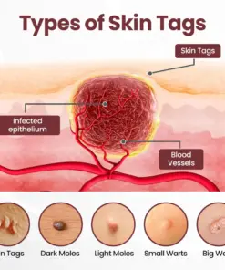 KUBOZN®KeraErase Dual-Action Renewal Cream