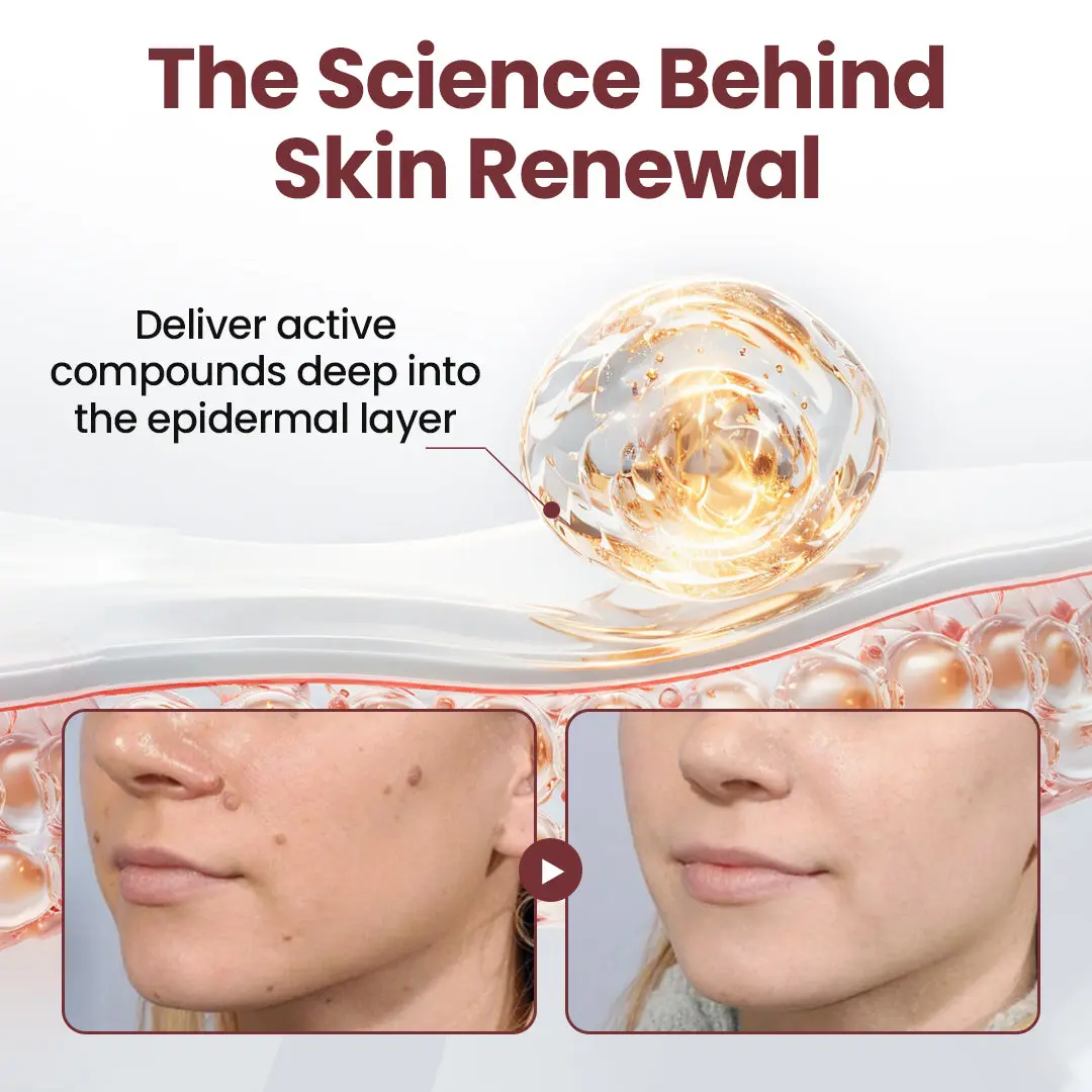 KUBOZN®KeraErase Dual-Action Renewal Cream