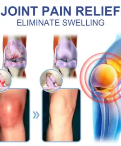 KUBOZN® Advanced Magnesium Absorption Cream for Arthritis, Neuropathy Joint Pain