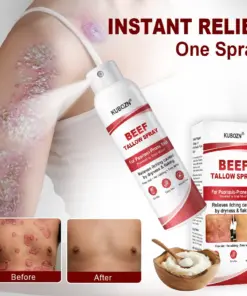 KUBOZN® Beef Tallow Spray for Itchy, Flaky Psoriasis Skin