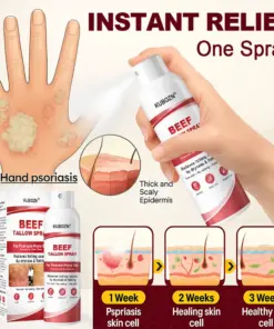 KUBOZN® Beef Tallow Spray for Itchy, Flaky Psoriasis Skin