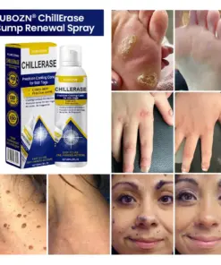 KUBOZN® ChillErase Cooling Spray for Skin Tags