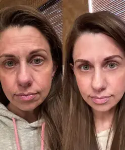 KUBOZN® GHK-Cu Microneedle Facial Patches