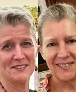 KUBOZN® GHK-Cu Microneedle Facial Patches