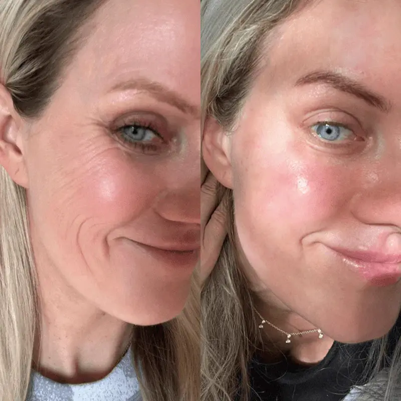 KUBOZN® GHK-Cu Microneedle Facial Patches