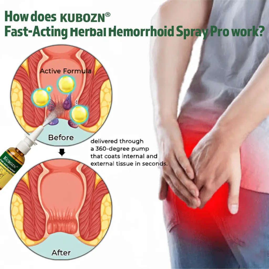 KUBOZN® Fast-Acting Herbal Hemorrhoid Spray Pro(Stops Bleeding Instantly Targets Internal/External Piles)