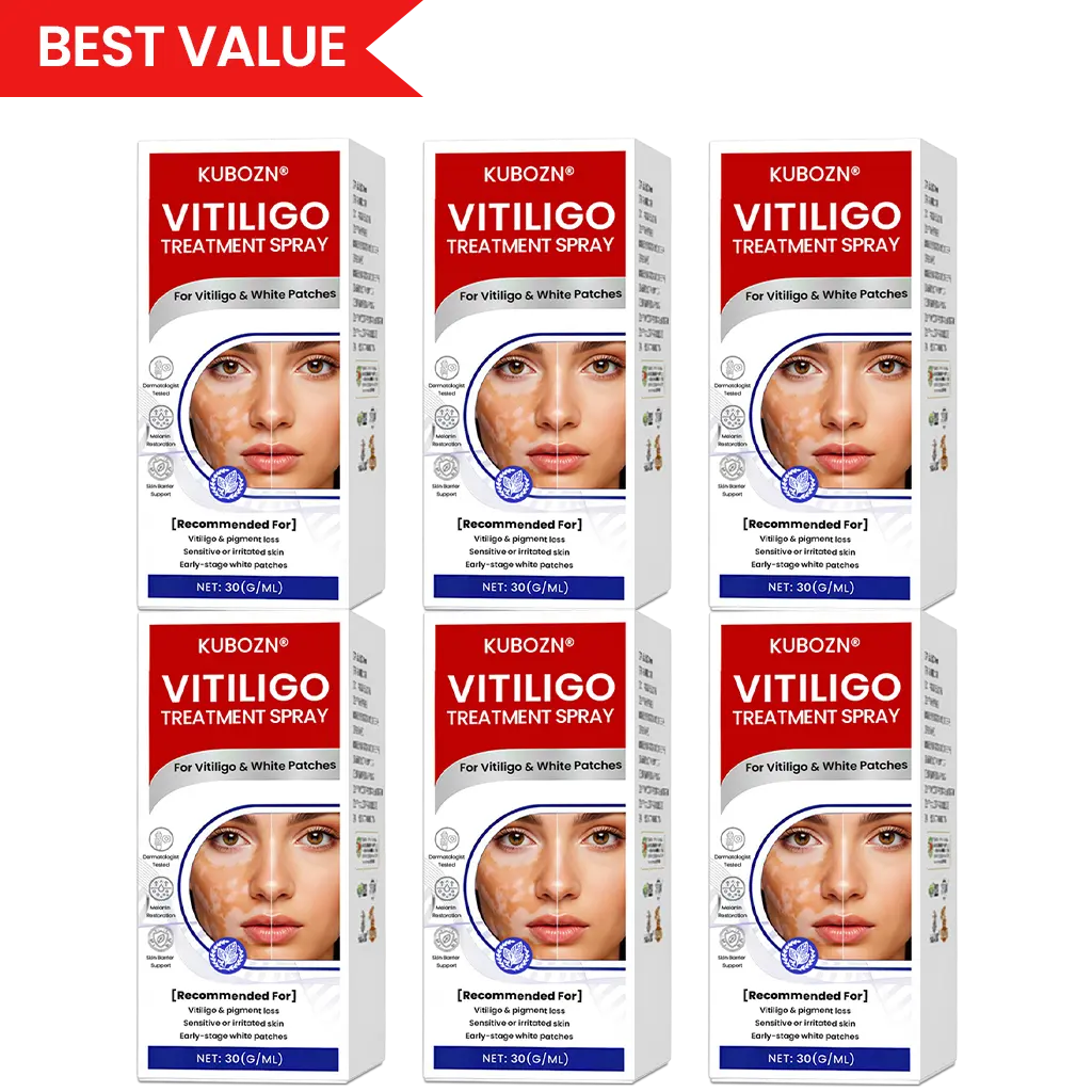 KUBOZN® Vitiligo Treatment Spray Visible Results in Weeks, 100 Natural Steroid-Free