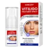 KUBOZN® Vitiligo Treatment Spray Visible Results in Weeks, 100 Natural Steroid-Free