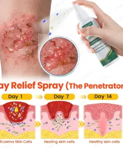 KUBOZN® Eczema Day & Night Repair System - 100% Steroid-Free Relief Duo for Intense Itch, Redness & Broken Skin