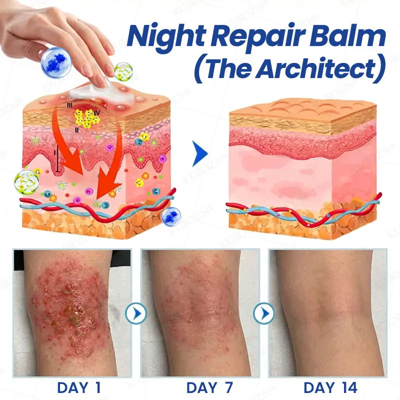 KUBOZN® Eczema Day & Night Repair System - 100% Steroid-Free Relief Duo for Intense Itch, Redness & Broken Skin