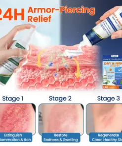 KUBOZN® Eczema Day & Night Repair System - 100% Steroid-Free Relief Duo for Intense Itch, Redness & Broken Skin