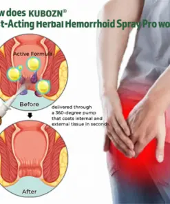 KUBOZN® Fast-Acting Herbal Hemorrhoid Spray Pro Stops Bleeding Instantly Targets Internal/External Piles