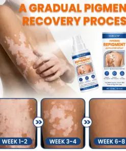 KUBOZN® Piperine Repigment Activator Spray to Reactivate Dormant Pigment Cells & Restore Natural Skin Color