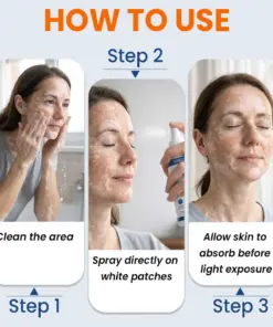 KUBOZN® Piperine Repigment Activator Spray to Reactivate Dormant Pigment Cells & Restore Natural Skin Color