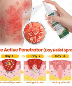 KUBOZN® Psoriasis Day & Night Repair System - 100% Steroid-Free Relief Duo for Plaques, Scaling & Itch