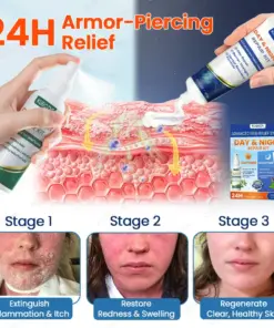 KUBOZN® Psoriasis Day & Night Repair System - 100% Steroid-Free Relief Duo for Plaques, Scaling & Itch