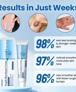 KUBOZN® Fragile Skin Repair Cream