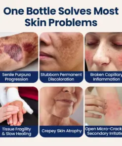 KUBOZN® DermFortify - Advanced Bruise Fading & Skin Thickening Cream for Thin, Fragile Skin